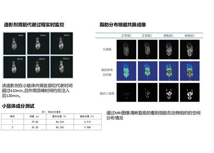 磁共振成像(MRI)